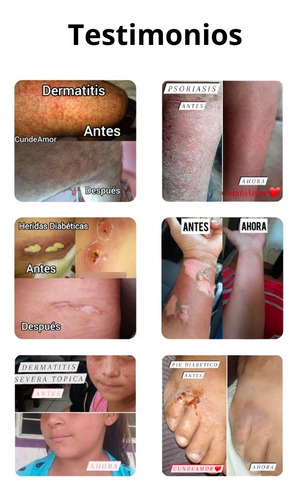 Paquete Jabón, Shampoo Y Crema Cundeamor