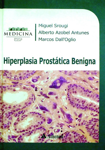 Hiperplasia prostática benigna, de Srougi, Miguel. Editorial Editora Atheneu Ltda, capa mole em português, 2010