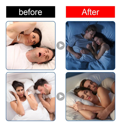 Cinta De Respiración Bucal Noctivo Para Dormir Cómodamente