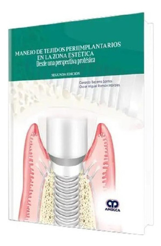 Libro - Manejo De Tejidos Periimplantarios En La Zona Estét