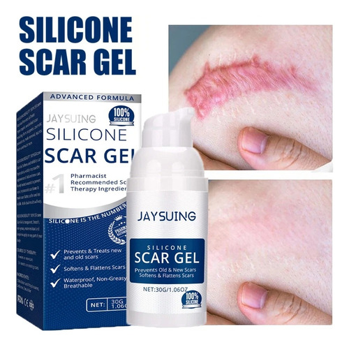 Gel De Silicona Para Eliminar Cicatrices De Cesárea Estrías Neutra