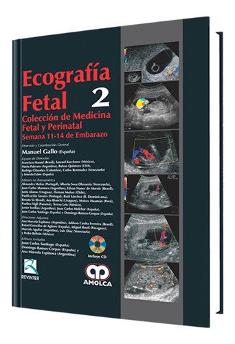 Ecografía Fetal De Semana 18-22 De Embarazo . Gallo Nº 2., De Manuel Gallo. Editorial Amolca, Tapa Dura En Español, 2010