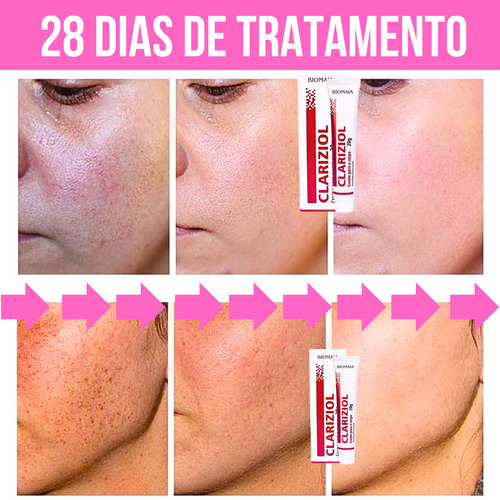 Melhor Clareador Para Melasma 2025 Clareador de Pele Melasma