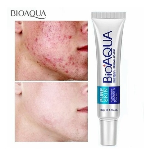 Crema Anti Acne Bioaqua Pure Skin Cicatrices Control Grasa