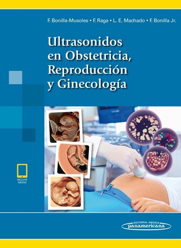 Ultrasonidos En Obstetricia, Reproducción Y Ginecología, De Fernando M. Bonilla Musoles. Editorial Médica Panamericana, Tapa Blanda En Español, 2018