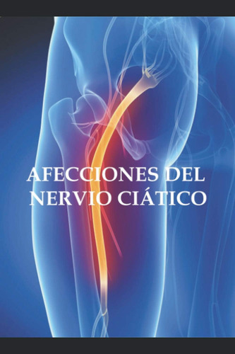 Libro Afecciones Del Nervio Ciático-adolfo Pérez Agustí