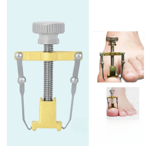 Kit Corrección Uñas Encarnadas Pie Herramienta Pedicura Lima