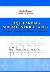 Taquicardias Supraventriculares, Mecanismos,diagnost