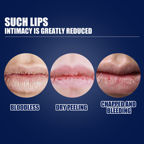 Hd El Lápiz Labial I Men Hidrata E Hidrata Los Labios,