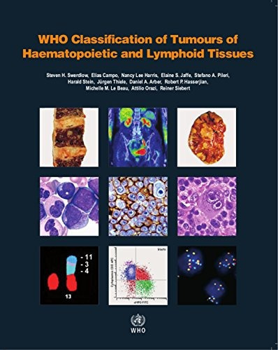 WHO Classification of Tumours of Haematopoietic and Lymphoi, de S. Swerdlow, E. Campo, N. L. Harris, E. S. Jaffe, S. A.. Editorial World Health Organization, tapa blanda en inglés, 0