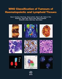 WHO Classification of Tumours of Haematopoietic and Lymphoi, de S. Swerdlow, E. Campo, N. L. Harris, E. S. Jaffe, S. A.. Editorial World Health Organization, tapa blanda en inglés, 0