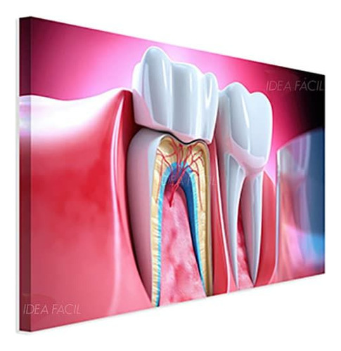 Cuadro Dentista Elegante Canvas Grueso 90x60cm