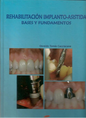 Libro Rehabilitación Implanto-asistida De Osvaldo Tomas Cacc