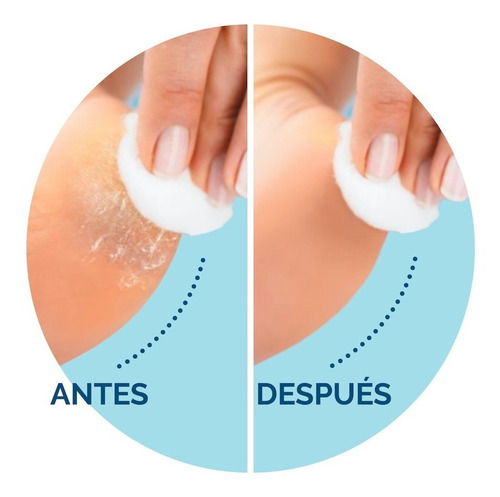 Exfoliador Eléctrico Para Pies Amopé Pedi Perfect