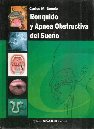 Libro Ronquido Y Apnea Obstructiva Del Sueño De Carlos M Boc