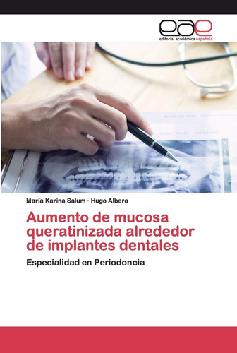 Libro: Aumento De Mucosa Queratinizada Alrededor De Implante