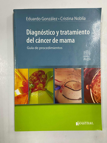Diagnóstico Y Tratamiento Del Cancer De Mamá
