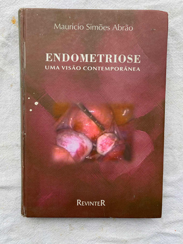 Livro Endometriose Uma Visão Contemporânea Maurício Simões