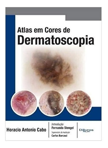 Atlas Em Cores De Dermatoscopia