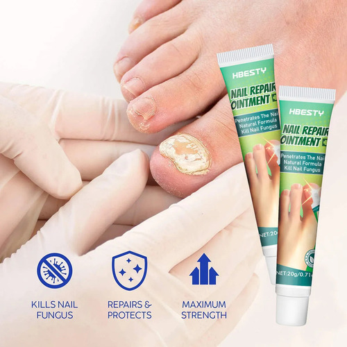 Crema Reparadora De Hongos Para Uñas, Gel Reparador De Uñas,