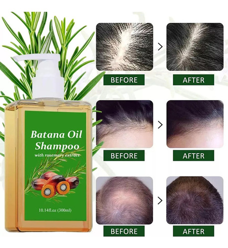 Batana - Shampoo Batana, Shampoo Com Óleo De Alecrim (1 Unid