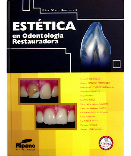 Estética En Odontología Restauradora: Estética En Odontología Restauradora, De Varios. Serie 8461104673, Vol. 1. Editorial Ripano, Tapa Blanda, Edición 2006 En Español, 2006