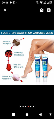 01 Pomada Tratamiento Varices Y Vasculitis Alivio Para Dolor