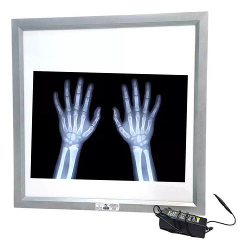 Negatoscopio Caja De Luz Led Ultradelgado Nueva Generación