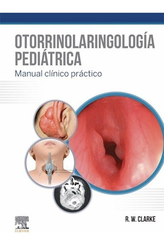 Otorrinolaringología Pediátrica - Manual Clìnico Práctico