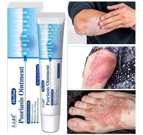 3x Crema Sin Caja Antibacteriana Psoriasis Dermatitis Eczema