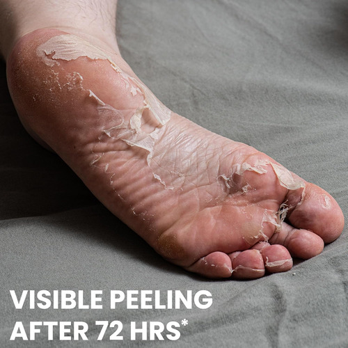 One's Own Mascarilla Coreana Peeling Y Exfoliante Para Pies,