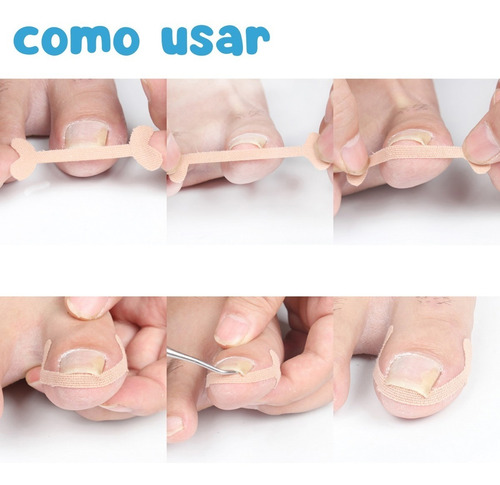 Kit Corrección Uñas Encarnadas Pie Herramienta Pedicura Lima