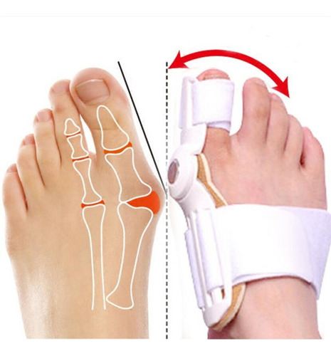 Férula Corrector Protector De Juanete Ortopédico Ajustable