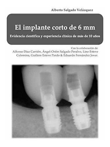 El Implante Corto De 6 Mm: Evidencia Científica Y Experienci