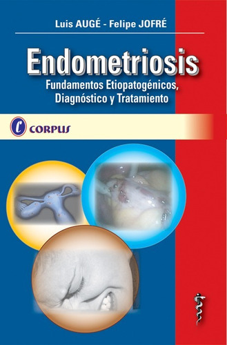 Auge Endometriosis Corpus