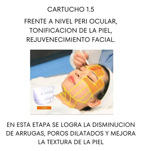 Alquiler Aparatologia Hifu 8d Adss Lifting Sin Cirugia