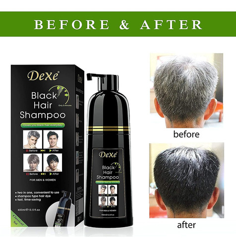 Shampoo De Tintura De Cabelo Preta Yuolita 400 Ml Cor 3