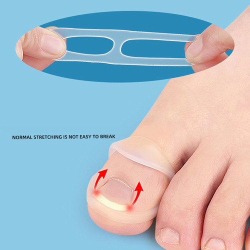 Ii 10 Piezas De Corrección De Uñas Encarnadas, Silicona,