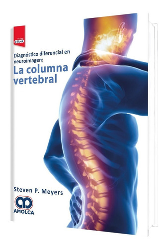 Diagnóstico Diferencial En Neuroimagen La Columna Vertebral 