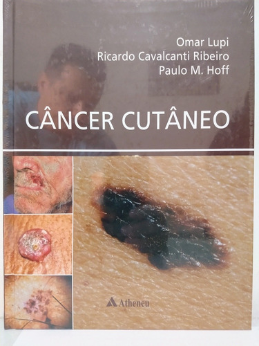 Livro - Câncer Cutâneo Omar Lupi