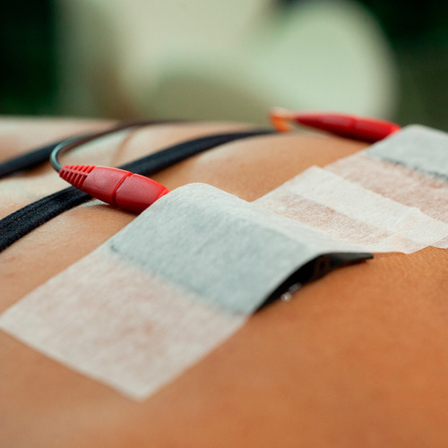Neurodyn Portátil Ibramed - Aparelho De Tens Burst 2 Canais