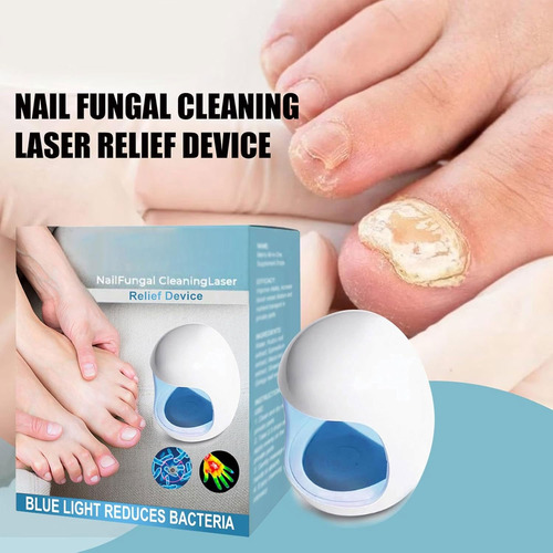 Tratamiento Láser De Hongos En Las Uñas Y Onicomicosis
