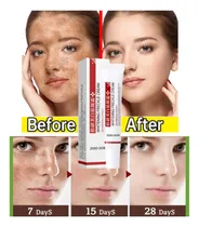 Comprar Creme Facial Clareador Melasma Acne Sardas Manchas Seleciona