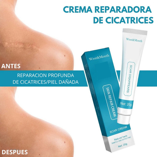 Crema Despigmentante De Manchas Para Cicatrices Paño Acne