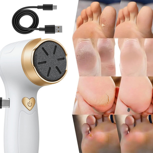 Motorzinho Para Lixar Calos Rachaduras Ideal Para Pedicures