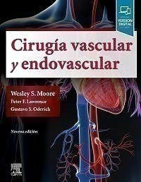 Cirugía Vascular Y Endovascular: Una Revisión Exhaustiva Ed