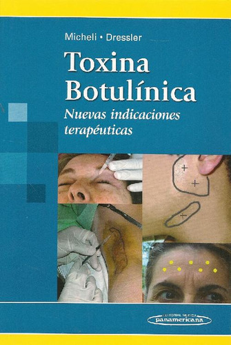 Libro Toxina Botulínica De Federico Eduardo Micheli Dirk Dre