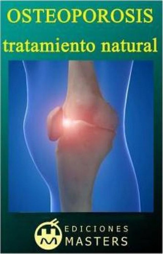 Osteoporosis : Tratamiento Natural