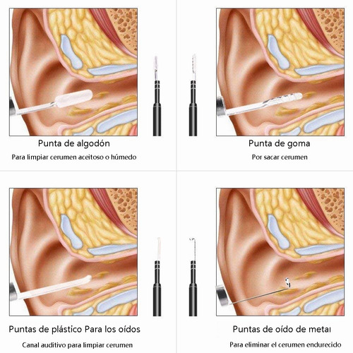 Imagen 7 de 7 de Otoscopio Digital, Cámara De Oídos Para Usar En Pc Y Celular