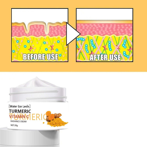 Turmeric Eye Cream Diminishing Fine Lines Around The Eyes Da